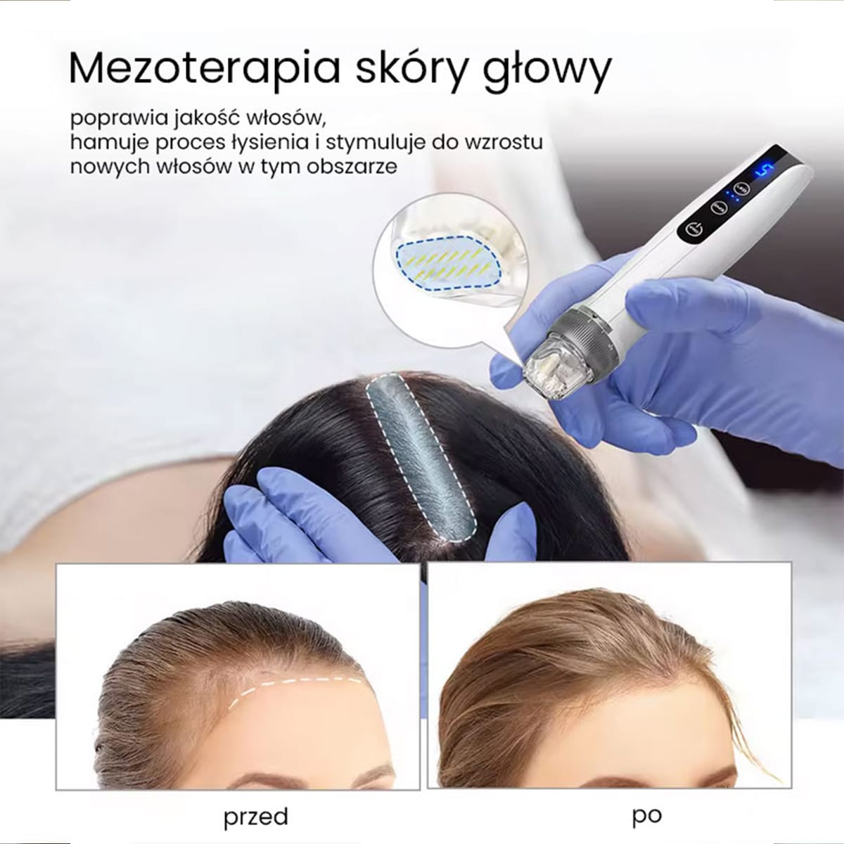 beautifly-collagenboost-dermapen-mit-ems-und-led-licht image 6