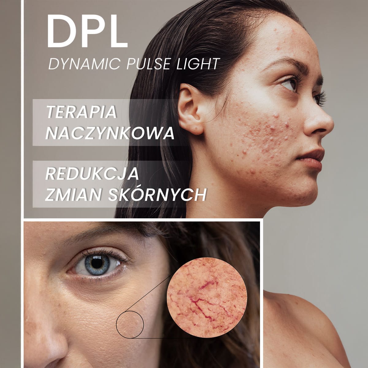beautifly-luminare-rejuva-skin-visage-ipl-dpl-laser-haarentferner image 6